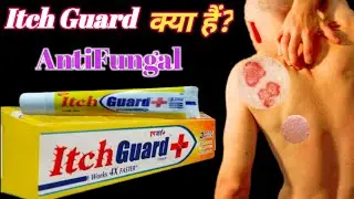 Itch Guard Kya Hai ? जानिए इसके उपयोग और साइड इफैक्ट्स#itch #itchiness #itchguard @HakimsahabAJK