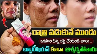 రాత్రి పడుకునే ముందు దీన్ని అప్లై చేయండి చాలు బ్యూటీషియన్ కూడా ఆశ్చర్యపోతారు | Tan Removal Remedy
