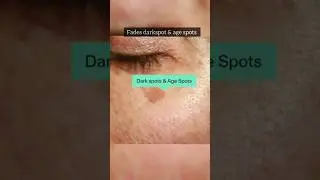 DERMATOUCH Bye Bye Pigmentation Cream review#darkspots#dermocosmetics#pigmentation#hyperpigmentation