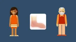 A Red, Swollen Foot Doesn't Always Mean an Infection
