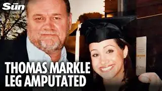 Meghan's dad Thomas Markle has leg AMPUTATED in life-saving op after hospital dash
