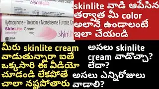 about skinlite cream//how to use skinlite cream//side effects//