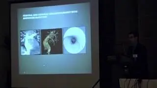 Imaging Guide to Transcatheter Procedures | Ahmanson/ UCLA Congential Heart Disease Center