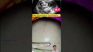 Baby Movements In The Womb👣🫣 | Nursing Educational video #babycare #pregnancy #shorts #shortsfeed