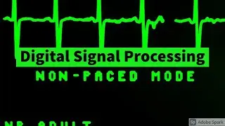 DSP -Developing 8 Point Radix-2 DIT FFT Algorithm - Part 1