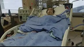 Rat bite results in open heart surgery, thousands in medical bills for Post Falls man