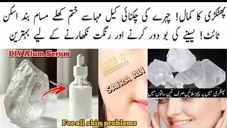 Alum Magic To Get Rid Of Wrinkles | Alum (Phitakri) For Skin Tightening| Minimize Open Pores