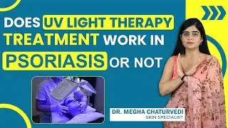 Does UV Light Therapy Treatment Work In Psoriasis Or Not | Explaining Truth About UV Light Therapy