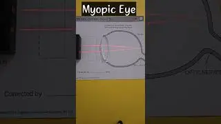 #Myopia#Myopiceye#Imageformation#myopiaexplainedclass10 #physicspractical #refraction_of_light