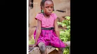 Before & After: Artificial Limb Fitting
