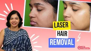 Лазерная эпиляция &mdash; полное видео процедуры из клиники Subodha Skin and Cosmetic.