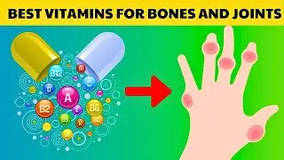 Top 8 Best Vitamins For Bones And Joints Health | Arthritis Cure