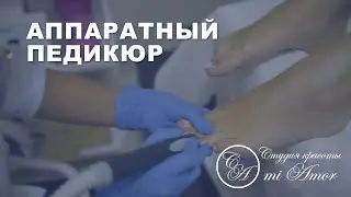 Аппаратный педикюр в студии красоты Mi Amor в Адлере