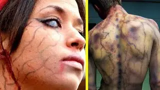 People Who SURVIVED LIGHTNING Strikes - Fact or Fiction?