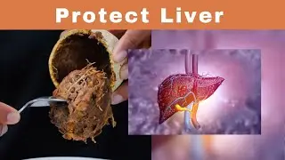 Wood Apple Protects Liver | Superfood Health Benefits