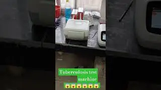 TrueNat TB Testing machine /RTPCR TEST #shortviralvideo testing by sputum samples