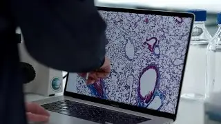 Transforming how we treat and prevent heart disease