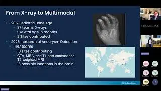 AI4C Lecture Series: Competition to Clinic: How AI Challenges Shape the Future of Radiology