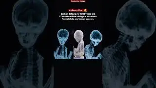 Newly Revealed Nazca Mummy 'Santiago': Alien Proof or Hoax?
