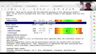 Methylation related Lab tests & Treatment for children with Autistic Spectrum Disorder