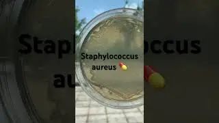 Staphylococcus aureus