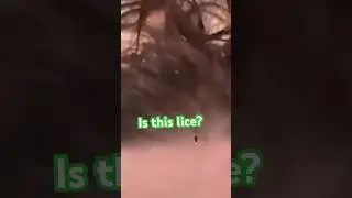 Это вши??? #вычесываниевшей #ШэннивоХристе