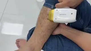 808nm Diode Laser Hair Removal Machine 755 808 1064 laser medical laser hair removal