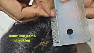 ASMR Lice Checking & Scalp Inspection