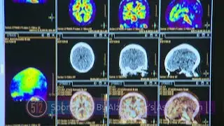 Texas Voters Consider Proposition 14: $3 Billion for Dementia Prevention & Research