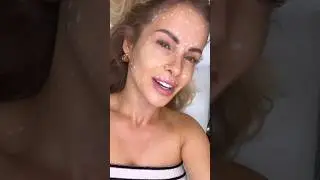 FULL FACE czyli -10lat dla Pauli Tumali #medycynaestetyczna #botox #btx #shorts #beauty #wrinkles