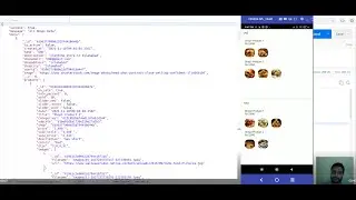 Complex Json (MVVM - GetX) - Part 2