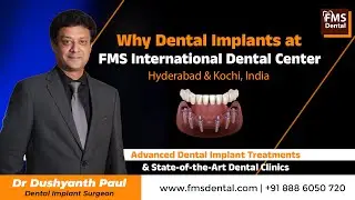 Why choose India for Dental Implant Treatments? |FMS International Dental Centers, Hyderabad & Kochi