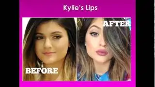 Celebrity Influence on Our Society