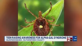 Murfreesboro teen raising awareness for alpha-gal syndrome