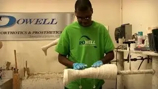 Eddie's Second Internship At Powell Orthotics & Prosthetics
