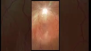#optometry #optometrists
