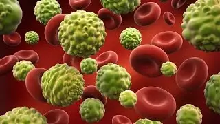 Cancer Treatment : Kill Cancer IN 48 Hours