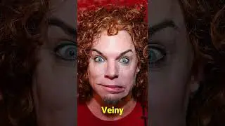 What Happened to Carrot Top&rsquo;s Face? 😳