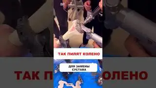 Хотите иметь в своем теле такую штуку?