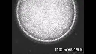 【ディテクトのハイスピードカメラ】脳室内の繊毛運動