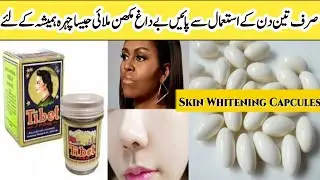 Tibet Cream Formula || Skin Whitening Cream || Tibet Cream Se Rang Gora Karne Ka Tarika!! 😱😱