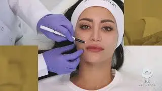 QUY TR&Igrave;NH THỰC HIỆN MESOTHERAPY - MESOGLOW Trẻ H&oacute;a Da