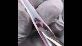 French plastic form system