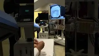 Dr. Elsharkawy shows Curonix Suprascapular Nerve PNS