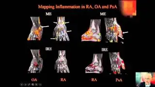 Voxel-by-voxel and pharmacokinetic analysis and dynamic MRI data