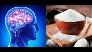 How sugar affects the brain: The Science Behind Sweet Tooth