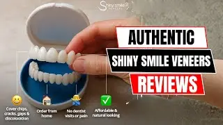 Shiny Smile Veneers: Customer Complaints & Happy Stories (Mixed Reviews)