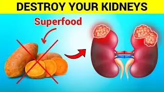 Surprising! Avoid These 6 Foods That Can Destroy Unhealthy Kidneys