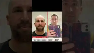 Steven Patrcik Duffield #hairtransplant Result | DRKAYA #hairclinic #haartransplantation #hairstyle