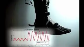 Towards wearable soft active orthotics (Wyss Institute Project)